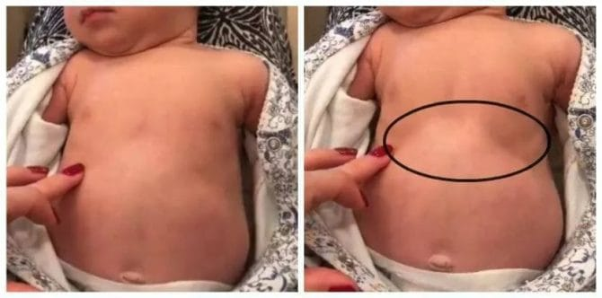 Cách nhận biết trẻ sơ sinh thở nhanh, nguyên nhân và cách phòng ngừa